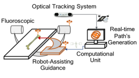 System Integration of a Fluoroscopic Image Calibration using Robot Assisted Surgical Guidance for Distal Locking Process in Closed Intramedullary Nailing of Femur