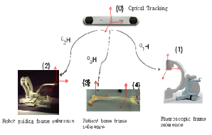 On the Design and Experiments of a Fluoro-Robotic Navigation System for Closed Intramedullary Nailing of Femur