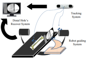 A Novel Surgical Navigation Concept for Closed Intramedullary Nailing of Femur using 4-DOF Laser-Guiding Robot