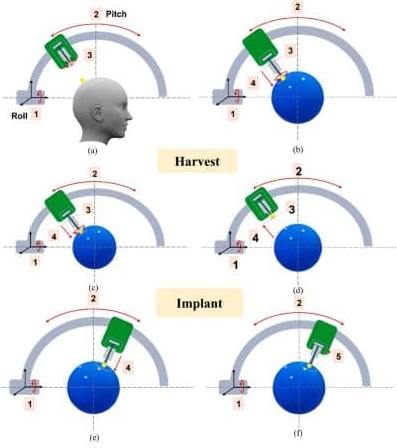 Design, Proof-of-Concept of Single Robotic Hair Transplant Mechanisms for Both Harvest and Implant of Hair Grafts