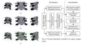 Intra-Operative Trajectory Realignment Algorithm for Minimizing Pedicle Screw Misplacement in Cervical Spinal Fusion